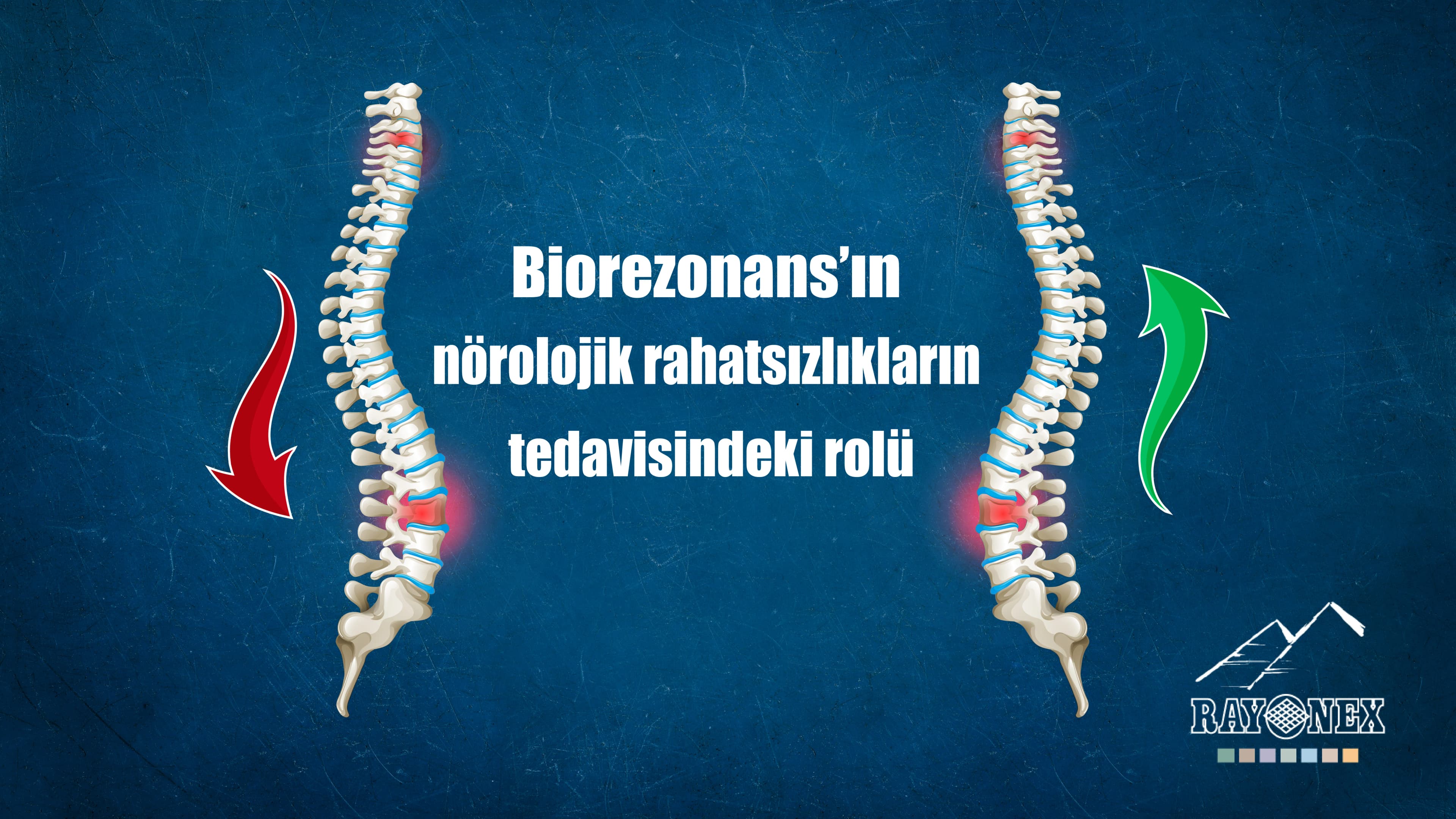 Biorezonans’ın nörolojik rahatsızlıkların tedavisindeki rolü