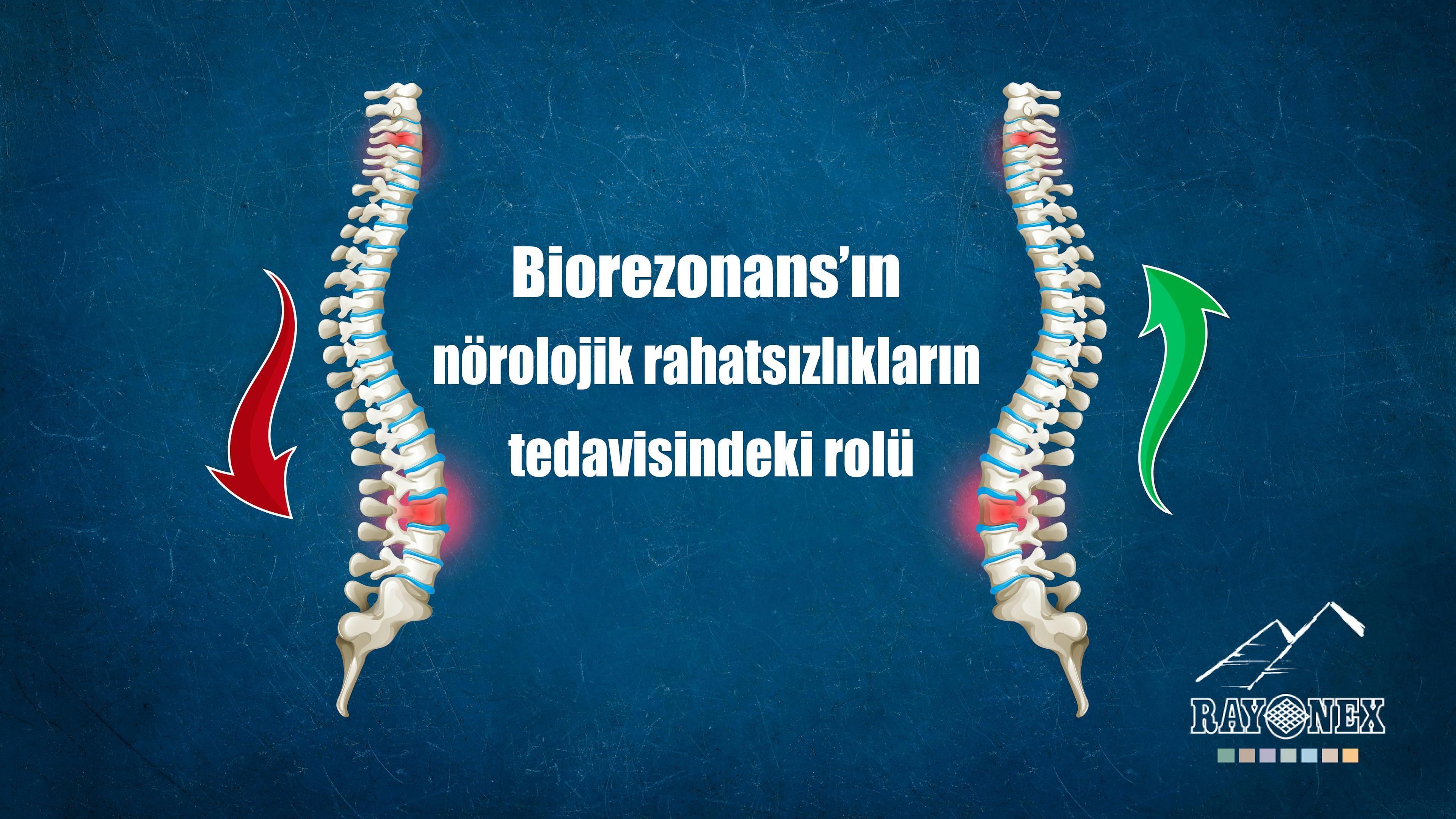Biorezonans’ın nörolojik rahatsızlıkların tedavisindeki rolü